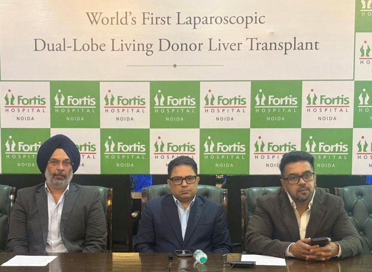 फोर्टिस नोएडा ने रचा इतिहास, दुनिया का पहला लैप्रोस्कोपिक डुअल-लोब लिविंग डोनर लिवर ट्रांसप्लांट सफल
